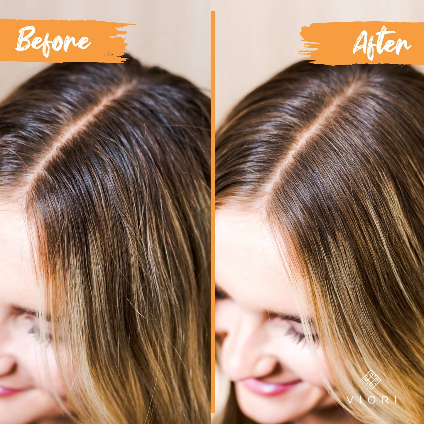 Rice Water Conditioner Bar | Citrus Zest EO | Oily Hair